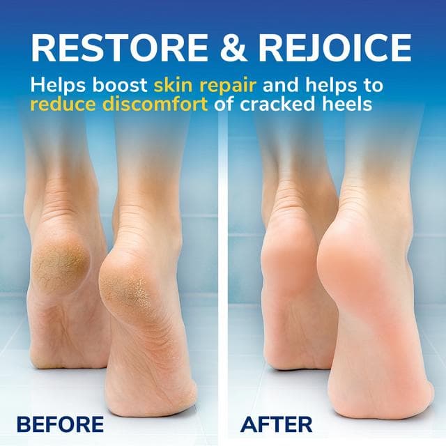 Scholl Cracked Heel Foot Cream Balm 60ml - gallery image 4