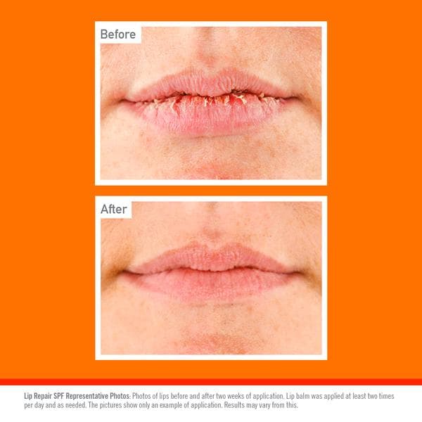 O'Keeffe's Lip Repair & Protect SPF 15 Lip Balm 4.2g - gallery image 5