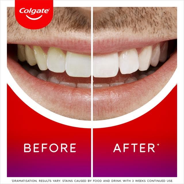 Colgate Max White Overnight Teeth Whitening Serum 2.5ml - gallery image 3