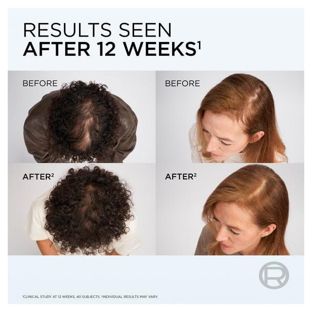 L'Oréal Paris Elvive Growth Booster Conditioner Anti Hair Loss & Thickening 150ml - gallery image 5