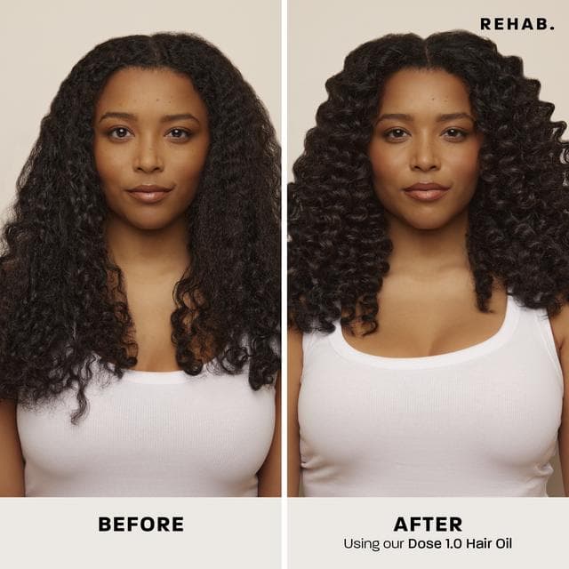 Rehab Dose 1.0 Hair Oil 30ml - gallery image 3