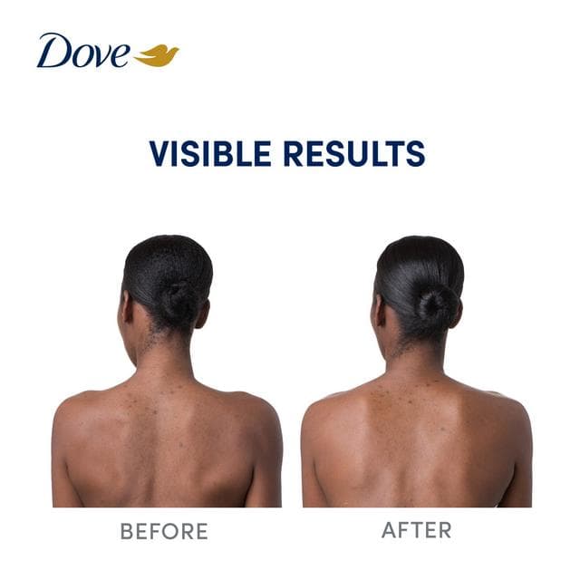 Dove 200ml Niacinamide + Even Tone Body Serum - gallery image 2